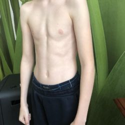 Podváha, chlapec 11 let, 30 kg